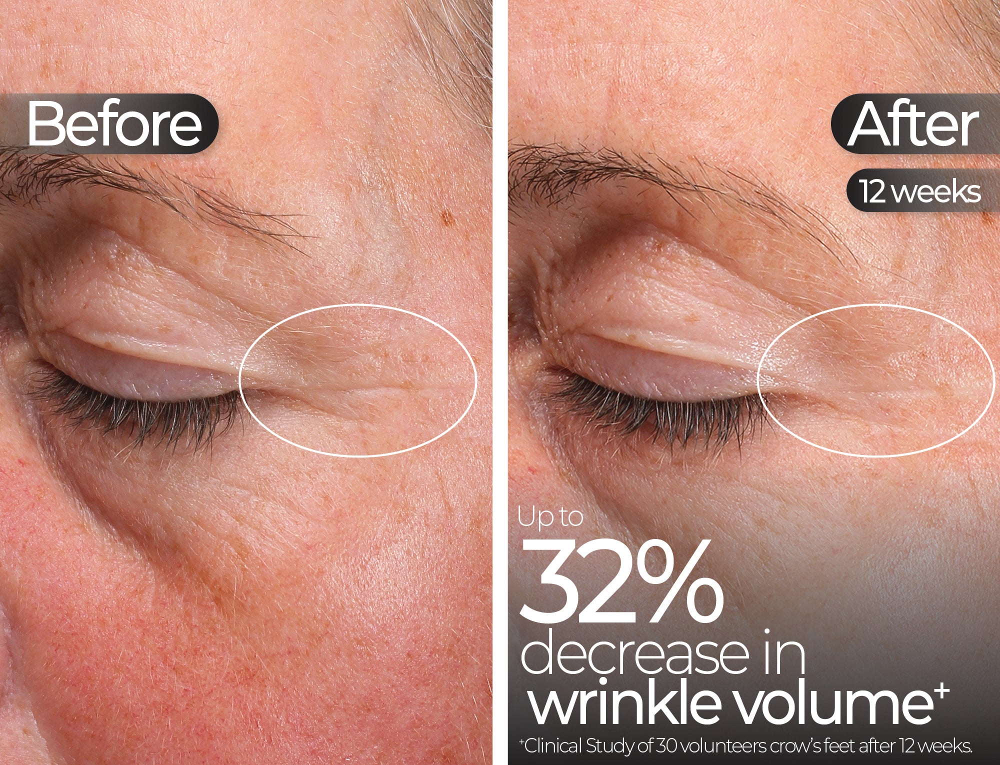 Before & After slide 2