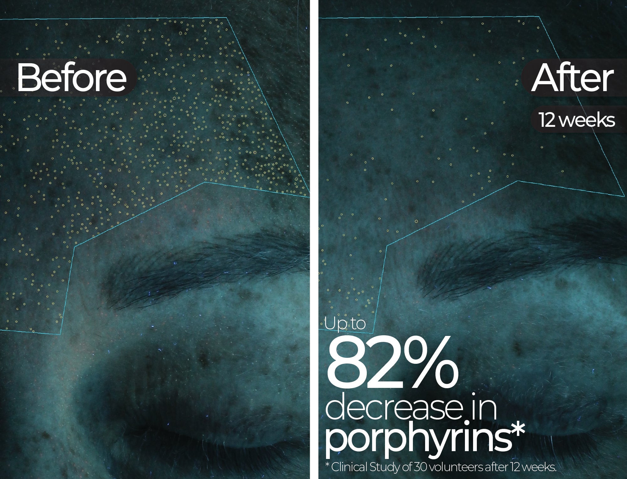 Before & After slide 3