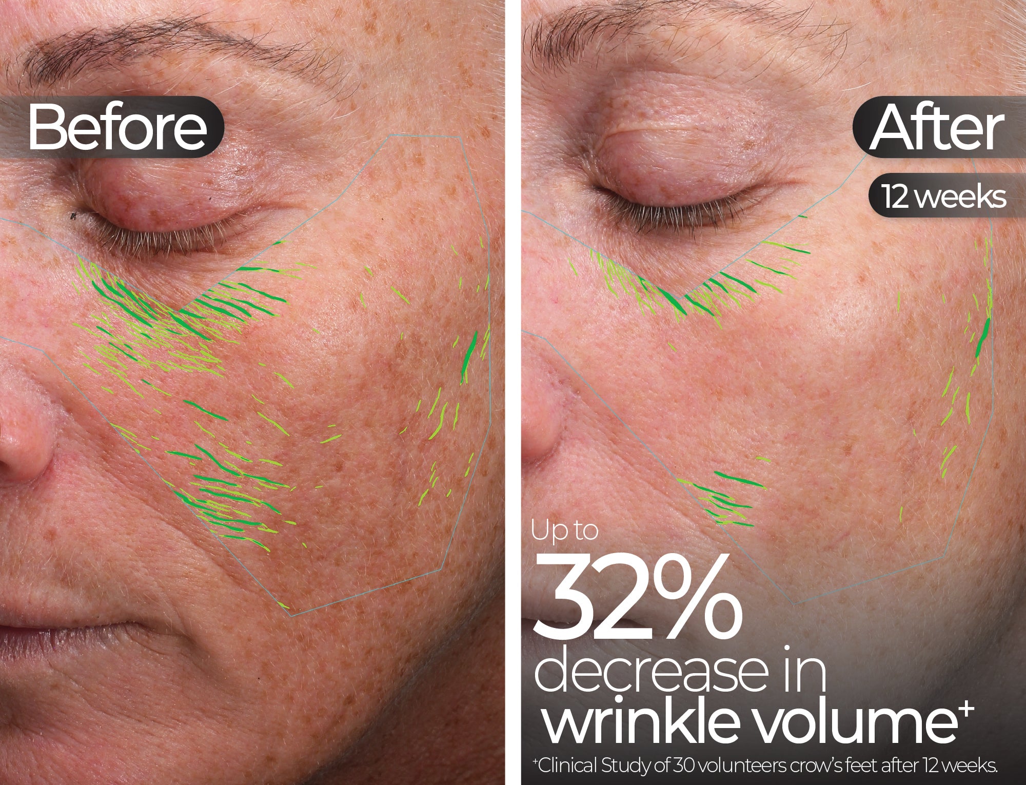 Before & After slide 4