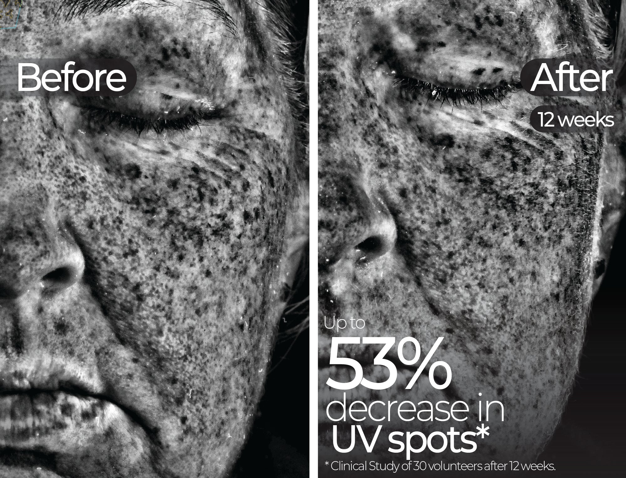 Before & After slide 6