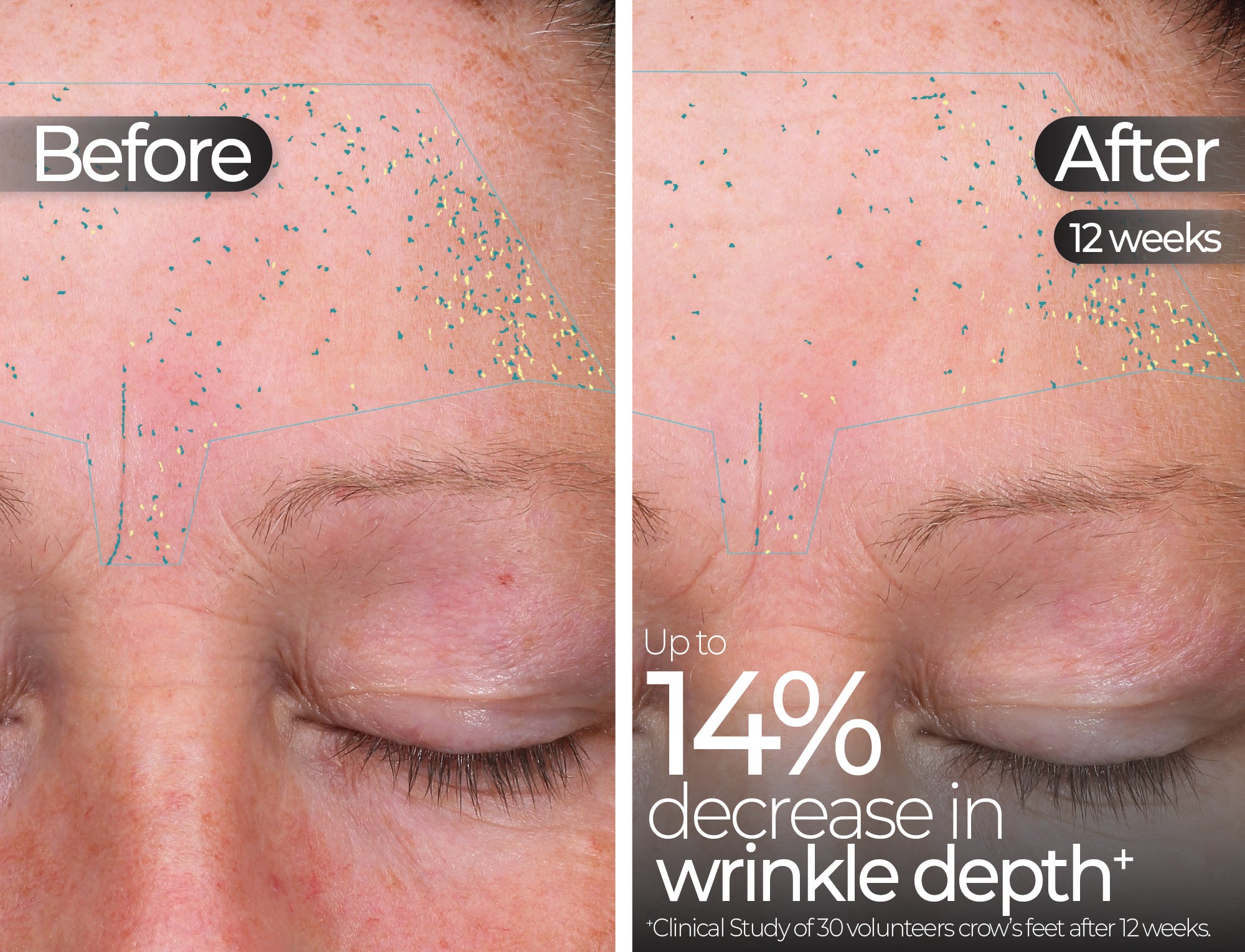 Before & After slide 10