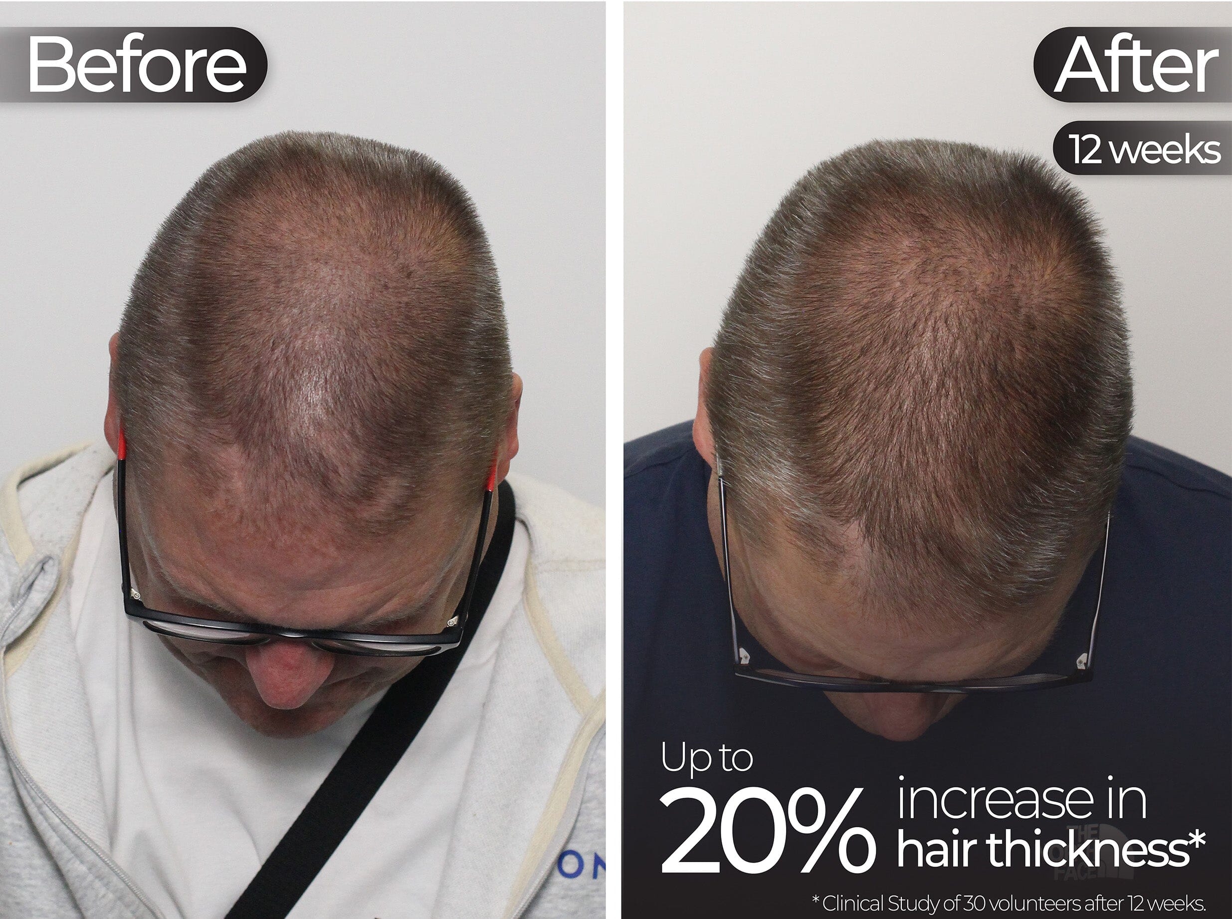 Before & After slide 2