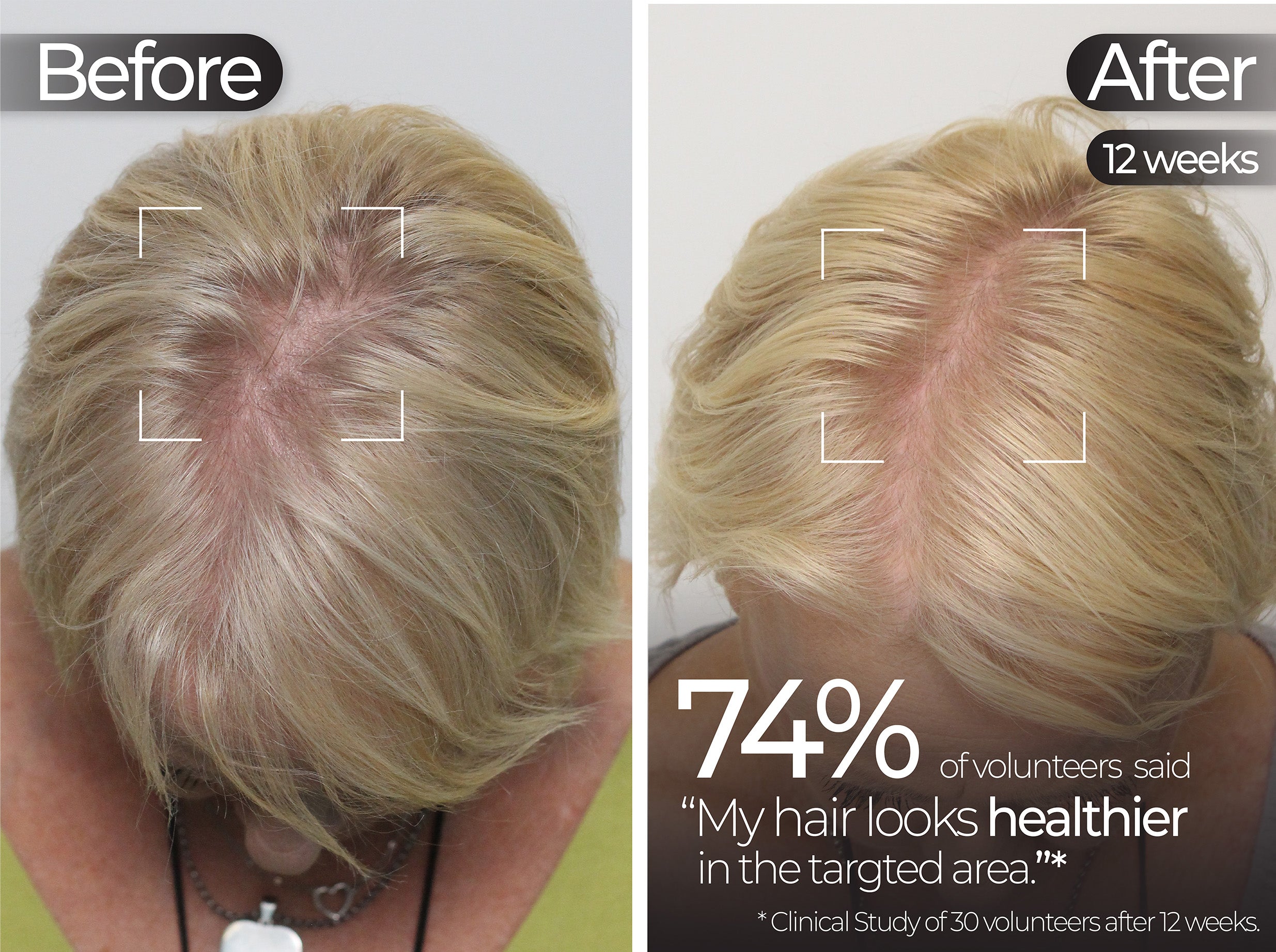 Before & After slide 4